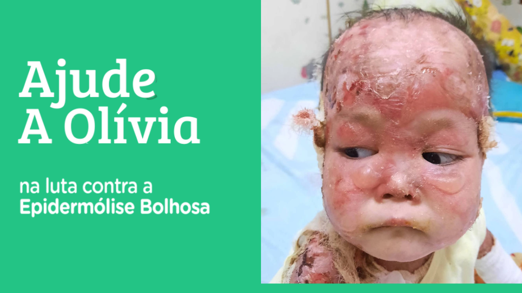 Campanha Ajude a Olívia